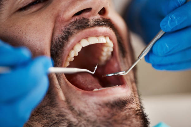 Best Emergency Care for Gum Disease in Washburn, IL
